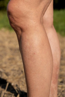 HIGHRES-01513-2